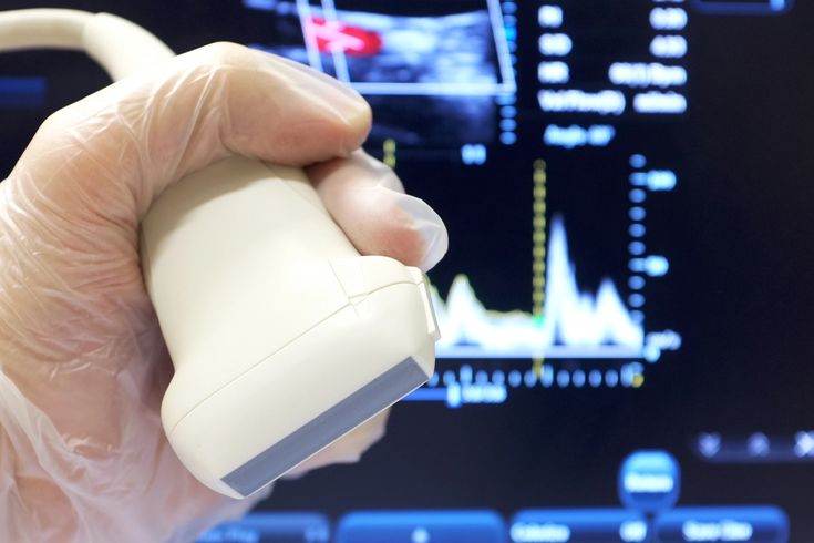 Material Teórico para el Curso de Ecografía Vascular Doppler de Miembros Inferiores: Diagnóstico Integral Arterial y Venoso