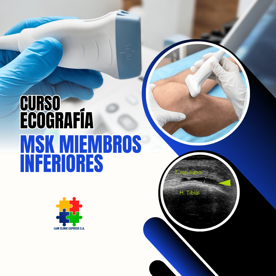 Curso de Ecografía Músculo Esquelética de Miembros Inferiores