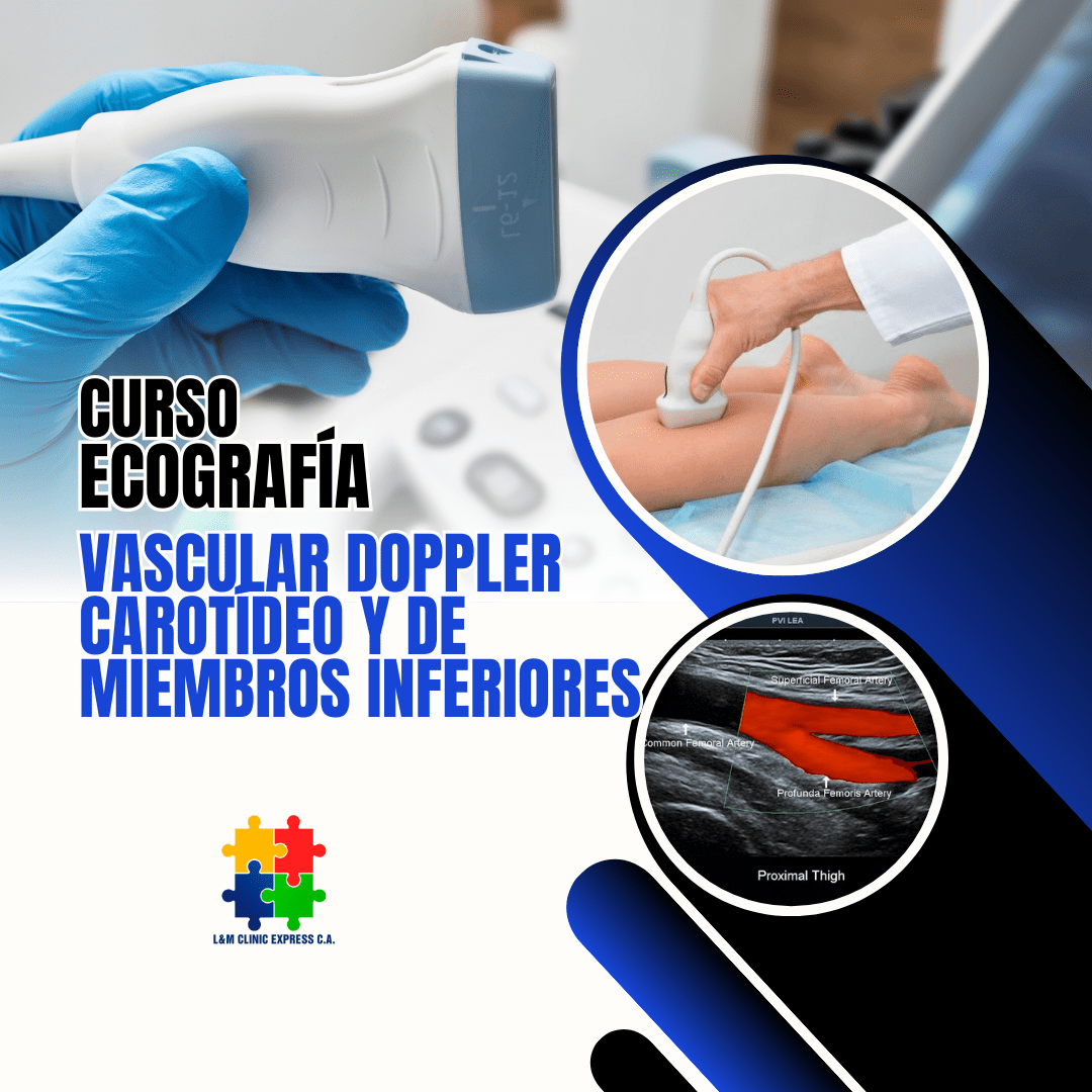 Curso de Ecografía Doppler Carotídeo y Miembros Inferiores